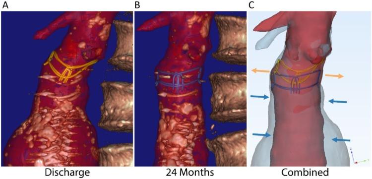 https://cdn.ncbi.nlm.nih.gov/pmc/blobs/e871/6864107/92ead980b7c3/10.1177_1526602819882379-fig3.jpg