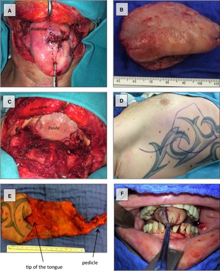https://cdn.ncbi.nlm.nih.gov/pmc/blobs/e87f/6394427/b993b518333d/405_2018_5245_Fig1_HTML.jpg