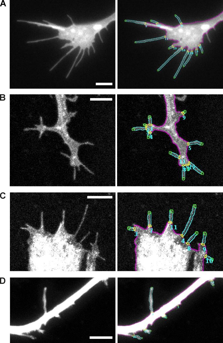 https://cdn.ncbi.nlm.nih.gov/pmc/blobs/e887/5626553/800e7e96458c/JCB_201705113_Fig2.jpg