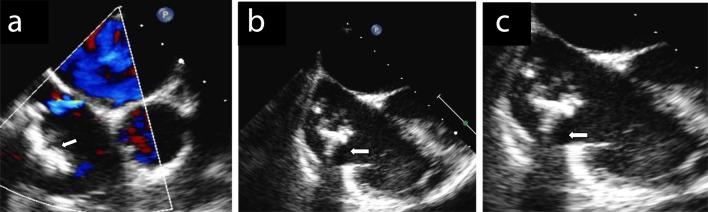 https://cdn.ncbi.nlm.nih.gov/pmc/blobs/e88b/5358228/f63bc1622887/cr-02-189-g001.jpg
