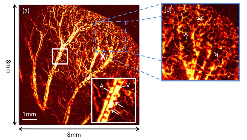 https://cdn.ncbi.nlm.nih.gov/pmc/blobs/e88b/5854068/debf7ac23301/boe-9-2-650-g005.jpg