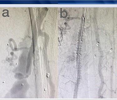 https://cdn.ncbi.nlm.nih.gov/pmc/blobs/e896/8599047/f1eb303d1b0e/rjab486f1.jpg