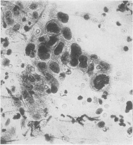 https://cdn.ncbi.nlm.nih.gov/pmc/blobs/e899/1552269/133dbe5e89bf/gut00722-0094-c.jpg