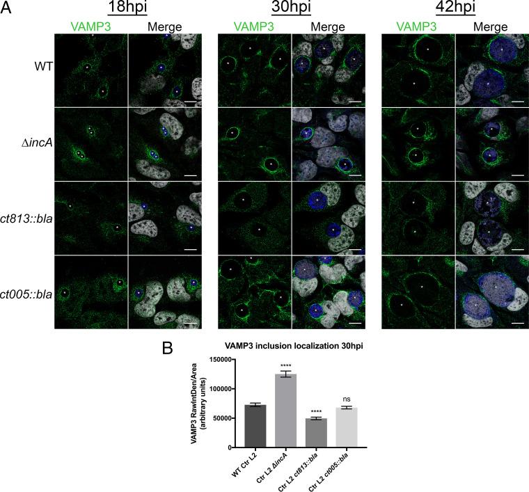 https://cdn.ncbi.nlm.nih.gov/pmc/blobs/e89c/7822134/503508e4c832/IAI.00409-20-f0005.jpg