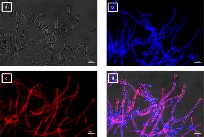 https://cdn.ncbi.nlm.nih.gov/pmc/blobs/e89d/11572700/052aa2c01067/spectrum.04269-23.f014.jpg