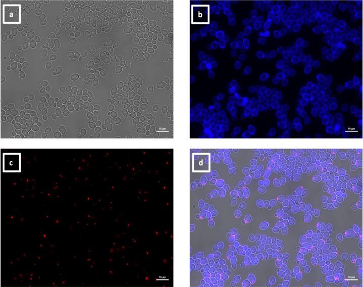 https://cdn.ncbi.nlm.nih.gov/pmc/blobs/e89d/11572700/0f4ca296a8a5/spectrum.04269-23.f012.jpg