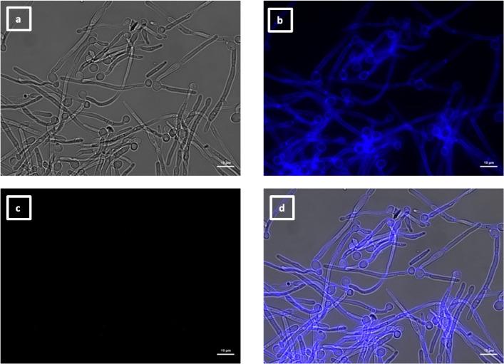 https://cdn.ncbi.nlm.nih.gov/pmc/blobs/e89d/11572700/ad7953c1f6d4/spectrum.04269-23.f015.jpg