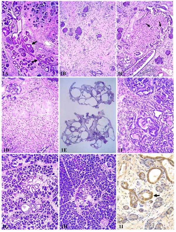https://cdn.ncbi.nlm.nih.gov/pmc/blobs/e8a2/1559682/6506a9f45ae0/1477-3163-5-19-1.jpg