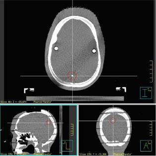 https://cdn.ncbi.nlm.nih.gov/pmc/blobs/e8a2/5711070/91329a122836/ACM2-15-032-g003.jpg