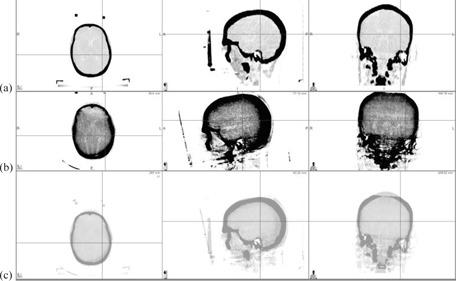 https://cdn.ncbi.nlm.nih.gov/pmc/blobs/e8a2/5711070/e290bf03b636/ACM2-15-032-g007.jpg
