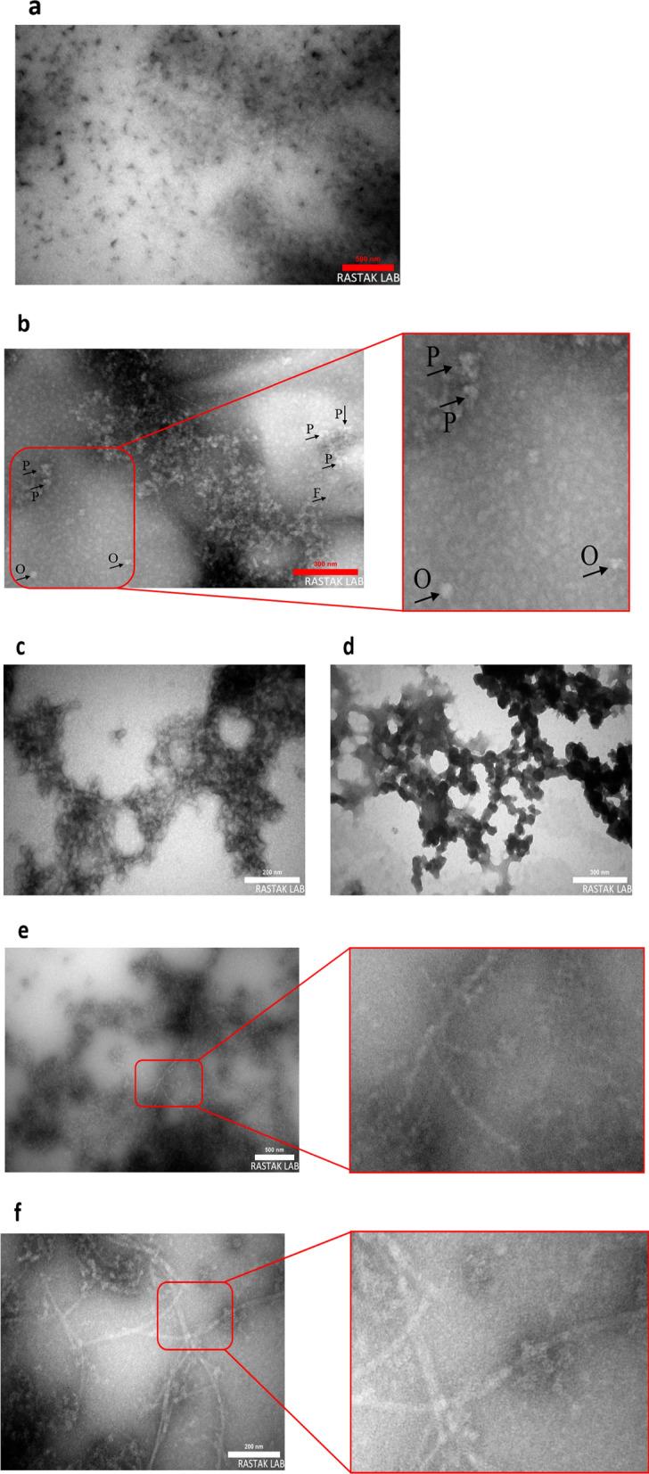https://cdn.ncbi.nlm.nih.gov/pmc/blobs/e8a6/11411779/92ea557bbefa/13065_2024_1289_Fig6a_HTML.jpg