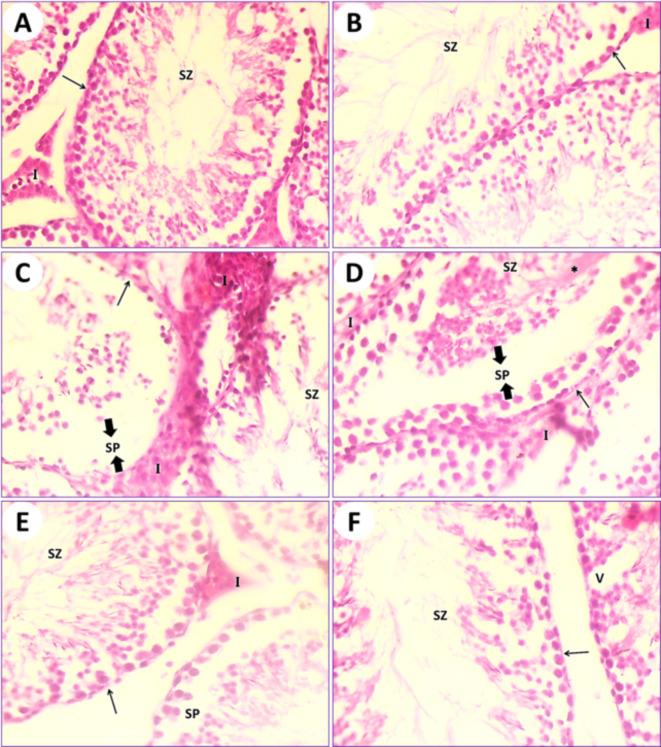https://cdn.ncbi.nlm.nih.gov/pmc/blobs/e8bb/11525657/af1030cc8862/41598_2024_74410_Fig5_HTML.jpg