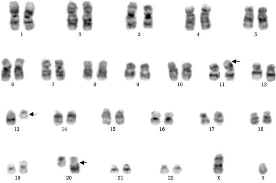 https://cdn.ncbi.nlm.nih.gov/pmc/blobs/e8bd/7982059/334812271a7c/BJBMS-21-246-g003.jpg