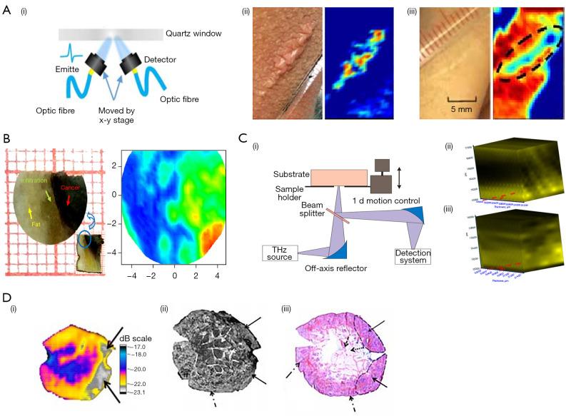 https://cdn.ncbi.nlm.nih.gov/pmc/blobs/e8c6/10722018/1b8cec77ad79/qims-13-12-8768-f5.jpg