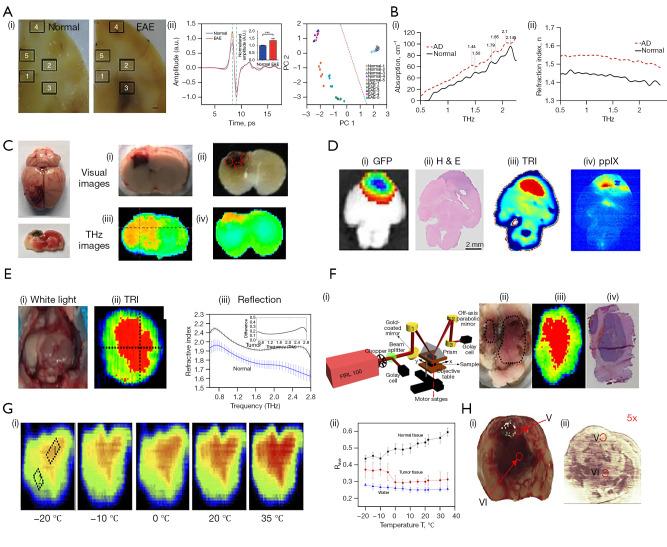 https://cdn.ncbi.nlm.nih.gov/pmc/blobs/e8c6/10722018/9aa50fae9842/qims-13-12-8768-f3.jpg