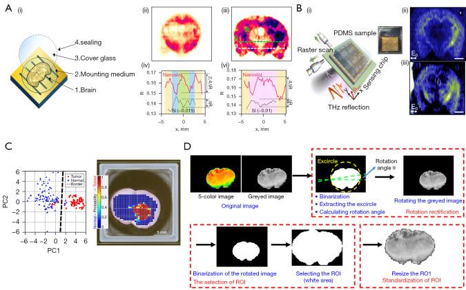 https://cdn.ncbi.nlm.nih.gov/pmc/blobs/e8c6/10722018/a188e77926d9/qims-13-12-8768-f4.jpg