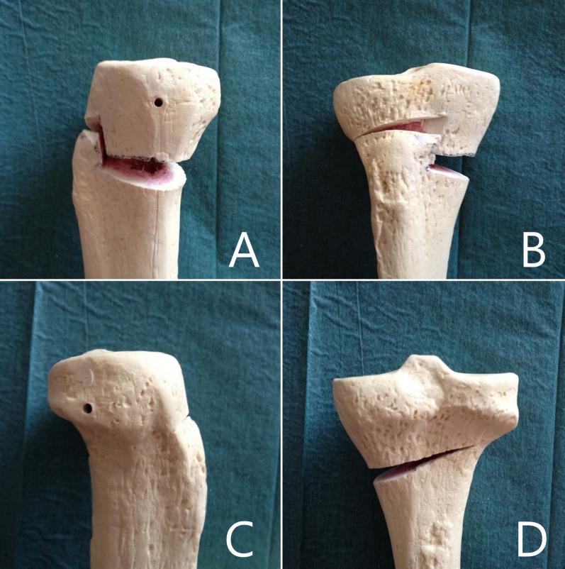 https://cdn.ncbi.nlm.nih.gov/pmc/blobs/e8c9/8671589/b6e22ce5519b/10195_2021_617_Fig1_HTML.jpg