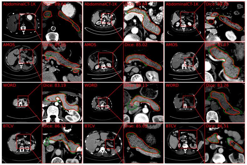 https://cdn.ncbi.nlm.nih.gov/pmc/blobs/e8cf/11674829/32ba6194021a/cancers-16-04268-g004a.jpg