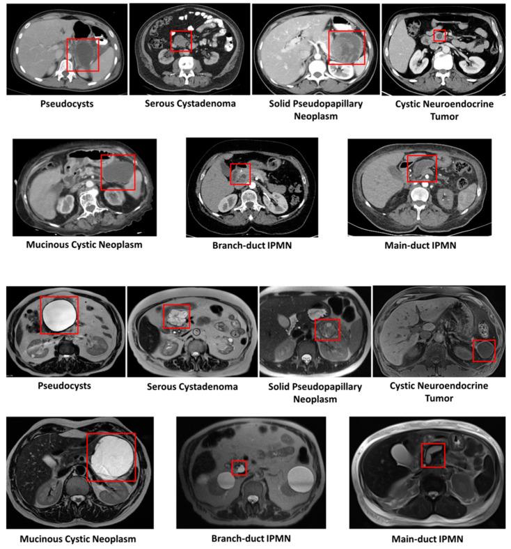 https://cdn.ncbi.nlm.nih.gov/pmc/blobs/e8cf/11674829/c5b710e41d17/cancers-16-04268-g003.jpg