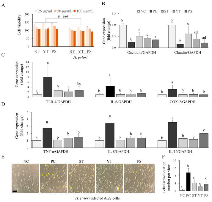 https://cdn.ncbi.nlm.nih.gov/pmc/blobs/e8d8/11172274/af97de878a91/cells-13-00901-g004.jpg