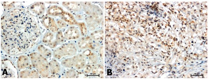 https://cdn.ncbi.nlm.nih.gov/pmc/blobs/e8dc/10299707/78619919e99f/ijms-24-10362-g001.jpg