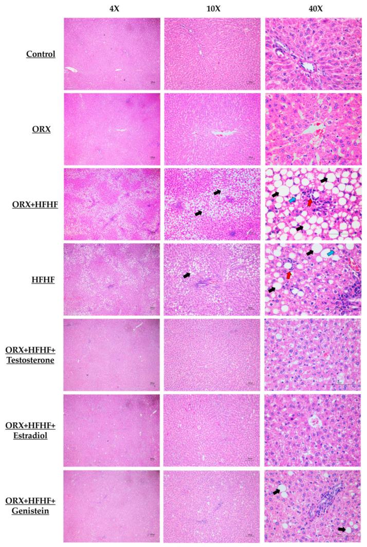 https://cdn.ncbi.nlm.nih.gov/pmc/blobs/e8e8/10968543/0eb0859a3b55/biomedicines-12-00483-g004.jpg