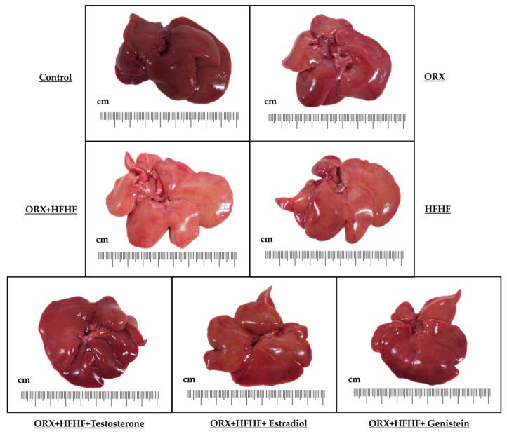 https://cdn.ncbi.nlm.nih.gov/pmc/blobs/e8e8/10968543/88f4bfb12eaf/biomedicines-12-00483-g003.jpg