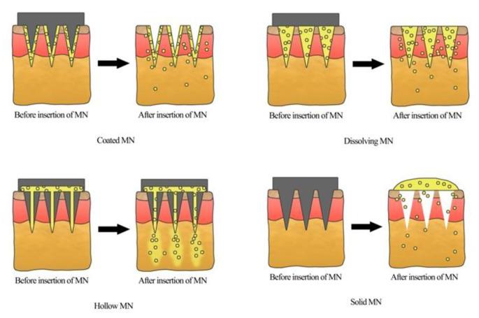 https://cdn.ncbi.nlm.nih.gov/pmc/blobs/e8ed/11683023/09ee23de3908/13346_2024_1679_Fig2_HTML.jpg