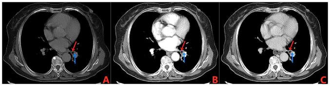 https://cdn.ncbi.nlm.nih.gov/pmc/blobs/e8f5/11465229/87d005f25b80/ol-28-06-14699-g01.jpg