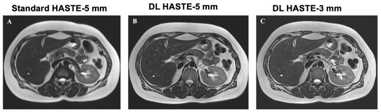 https://cdn.ncbi.nlm.nih.gov/pmc/blobs/e8f7/11763676/c76b707b547f/curroncol-32-00030-g002.jpg