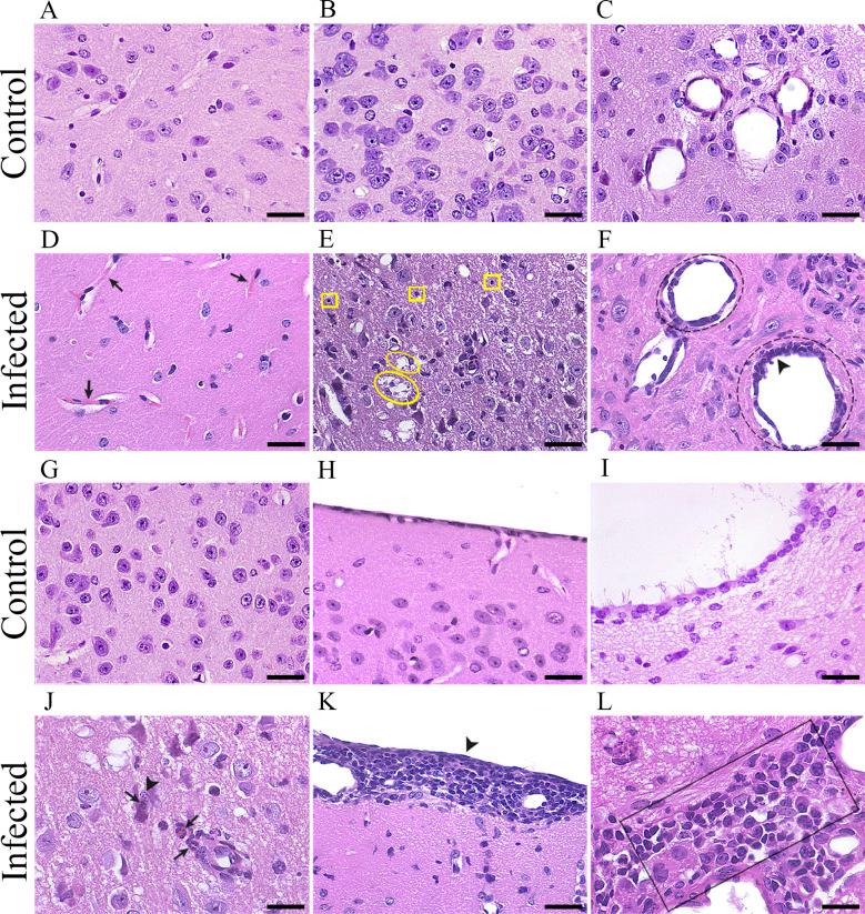 https://cdn.ncbi.nlm.nih.gov/pmc/blobs/e902/11897020/9389ba29cd7a/fcimb-15-1499658-g006.jpg