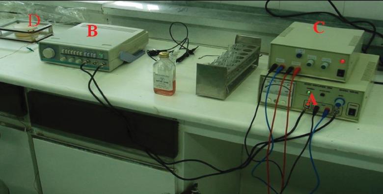 https://cdn.ncbi.nlm.nih.gov/pmc/blobs/e906/3866534/9bda26237138/Cell-J-15-310-g02.jpg