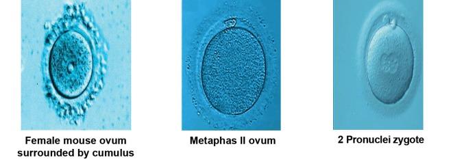 https://cdn.ncbi.nlm.nih.gov/pmc/blobs/e906/3866534/b56dec5d4991/Cell-J-15-310-g01.jpg