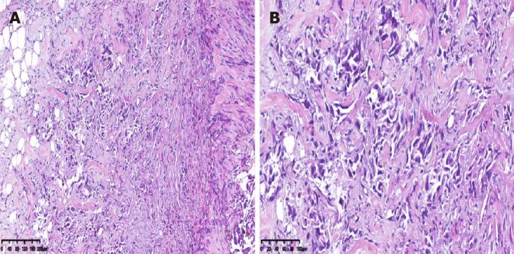 https://cdn.ncbi.nlm.nih.gov/pmc/blobs/e908/8040059/a5efc7bbeca2/WJGO-13-305-g004.jpg