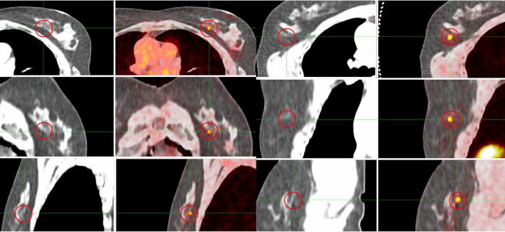 https://cdn.ncbi.nlm.nih.gov/pmc/blobs/e90a/12061632/1a9dde3d6670/CAAC-75-226-g001.jpg