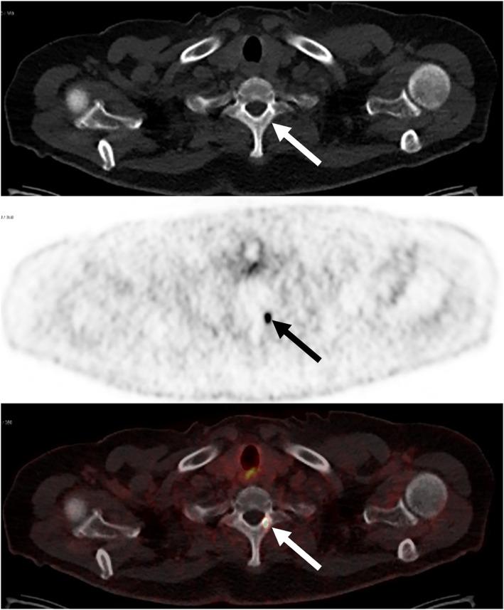 https://cdn.ncbi.nlm.nih.gov/pmc/blobs/e90a/12061632/b25b0c683fff/CAAC-75-226-g002.jpg