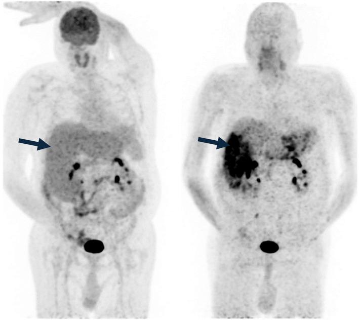 https://cdn.ncbi.nlm.nih.gov/pmc/blobs/e90a/12061632/fd19e6eafe6e/CAAC-75-226-g004.jpg