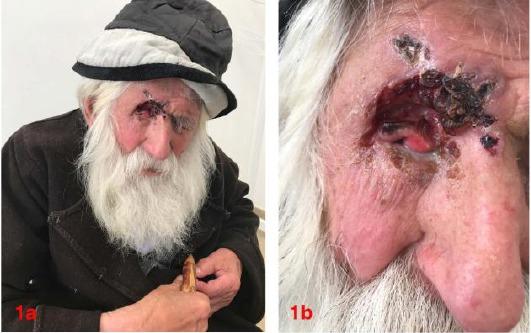 https://cdn.ncbi.nlm.nih.gov/pmc/blobs/e90d/5816281/ff2baf5fe00e/OAMJMS-6-126-g001.jpg