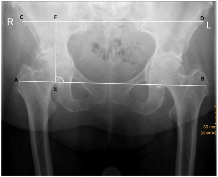 https://cdn.ncbi.nlm.nih.gov/pmc/blobs/e914/10299585/978ca53e374b/jcm-12-03941-g005.jpg