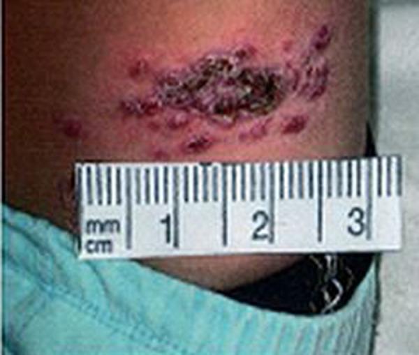 https://cdn.ncbi.nlm.nih.gov/pmc/blobs/e91a/3560647/86f9a6c8f4d9/medscimonit-18-9-BR356-g003.jpg
