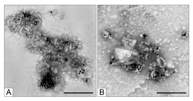 https://cdn.ncbi.nlm.nih.gov/pmc/blobs/e929/8624966/df5bd6730881/nanomaterials-11-02775-g005.jpg