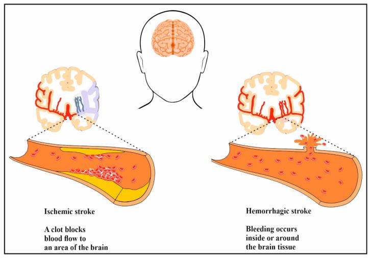 https://cdn.ncbi.nlm.nih.gov/pmc/blobs/e92b/10669285/c7b46f99da24/biomedicines-11-03010-g001.jpg