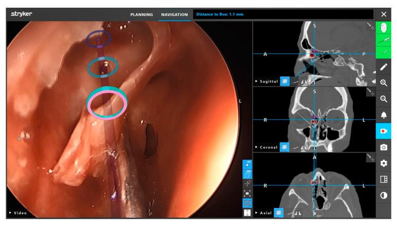 https://cdn.ncbi.nlm.nih.gov/pmc/blobs/e92e/9599272/575b184c3cc6/brainsci-12-01337-g005.jpg