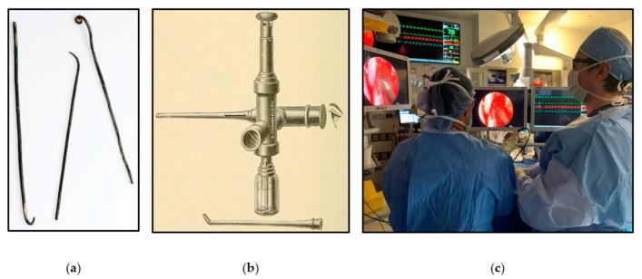 https://cdn.ncbi.nlm.nih.gov/pmc/blobs/e92e/9599272/7a316b6411d3/brainsci-12-01337-g001.jpg