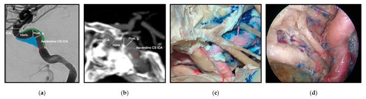 https://cdn.ncbi.nlm.nih.gov/pmc/blobs/e92e/9599272/7cdf7ae23d93/brainsci-12-01337-g008.jpg