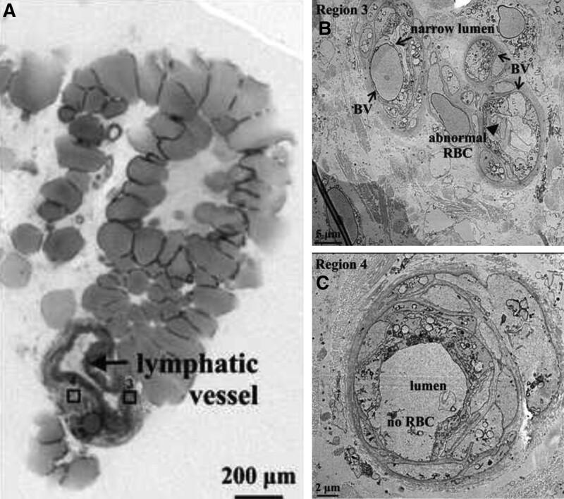 https://cdn.ncbi.nlm.nih.gov/pmc/blobs/e92f/10807887/01ad6f2d47bb/gox-12-e5547-g004.jpg