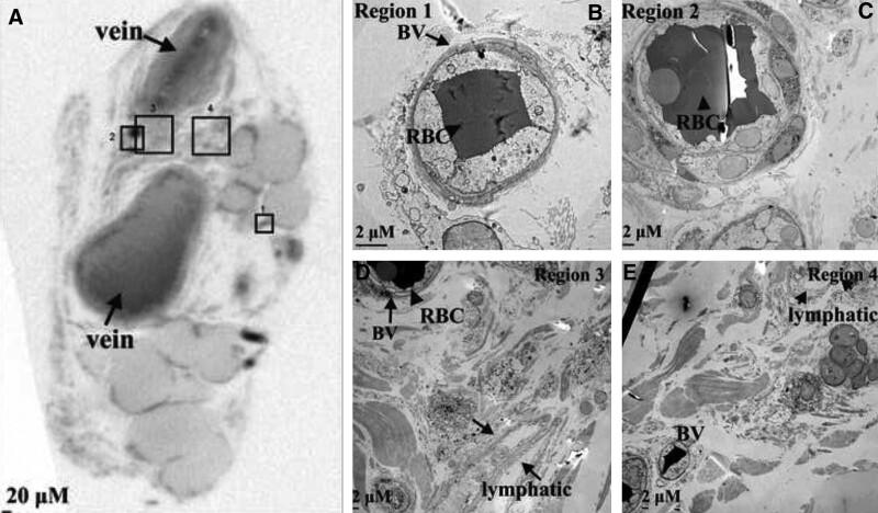 https://cdn.ncbi.nlm.nih.gov/pmc/blobs/e92f/10807887/ab31aeb5ec07/gox-12-e5547-g006.jpg