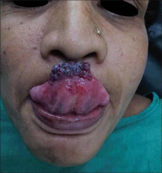 https://cdn.ncbi.nlm.nih.gov/pmc/blobs/e931/5512415/5ea084d486df/NJMS-8-78-g002.jpg