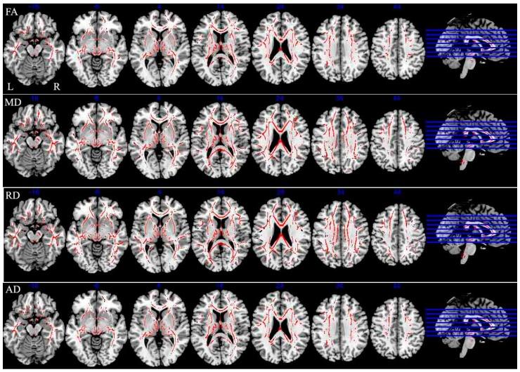 https://cdn.ncbi.nlm.nih.gov/pmc/blobs/e934/5297681/0ee7e1d01fbb/ijms-18-00046-g003.jpg