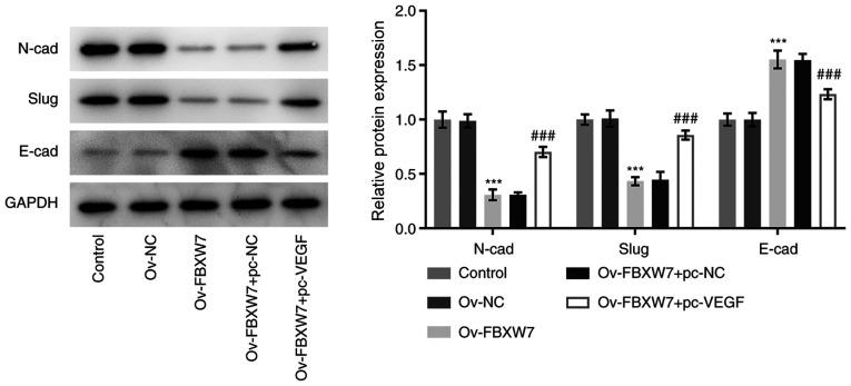 https://cdn.ncbi.nlm.nih.gov/pmc/blobs/e937/8005732/0c73cb5be4f1/etm-21-05-09945-g02.jpg